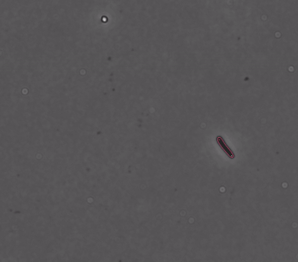 An illustration of DeLTA's performance on an agar pad movie of E. Coli